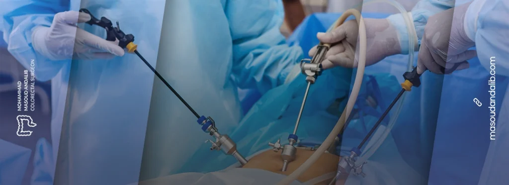 لاپاراسکوپی سرطان روده؛ روش انجام، مزایا و مراقبتها 1 Laparoscopy for colorectal cancer