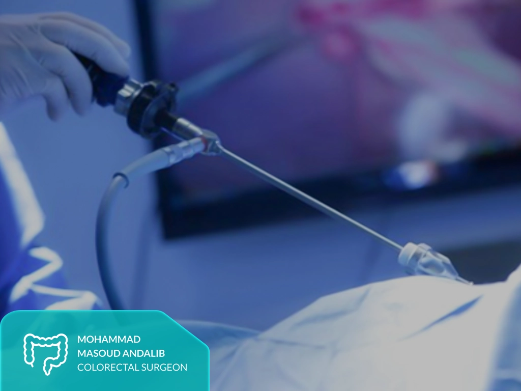 لاپاراسکوپی سرطان روده؛ روش انجام، مزایا و مراقبتها 2 لاپاراسکوپی سرطان روده
