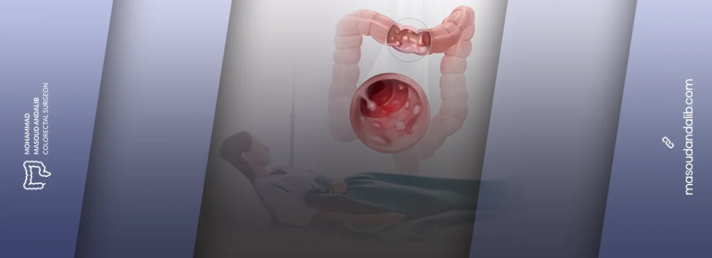 راهنمای جامع جراحی روده بزرگ سرپایی 6 راهنمای جامع جراحی روده بزرگ سرپایی