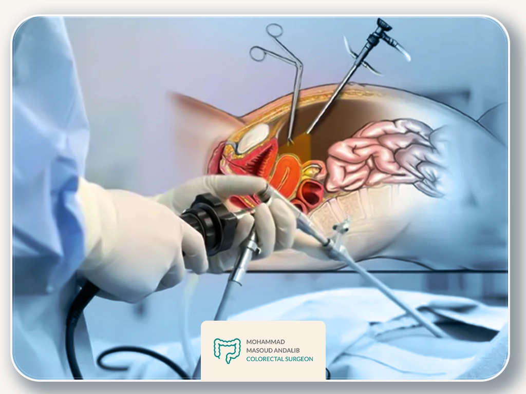 راهنمای جامع جراحی روده بزرگ سرپایی 1 راهنمای جامع جراحی روده بزرگ سرپایی