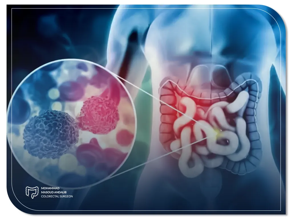 ۱۰ علامت اولیه سرطان روده بزرگ که نباید نادیده بگیرید 4 ۱۰ علامت اولیه سرطان روده بزرگ